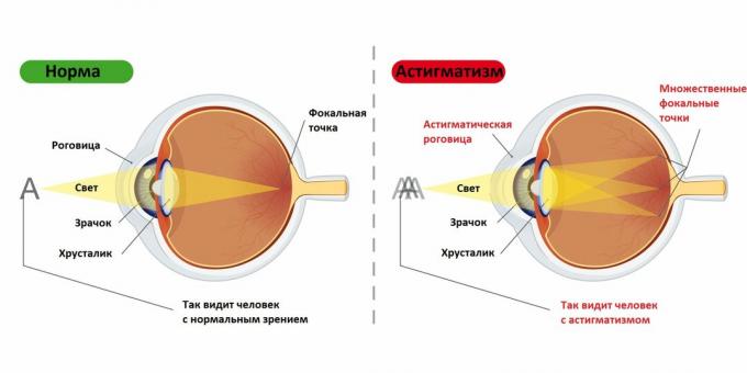 Visjon om en person med og uten astigmatis