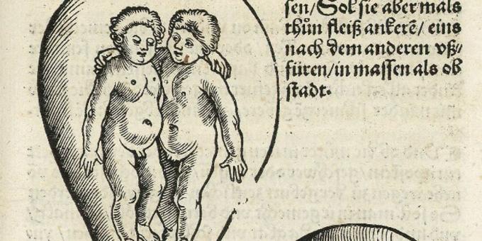 Barn i middelalderen: Tvillinger i livmoren, Eucharius Rodion