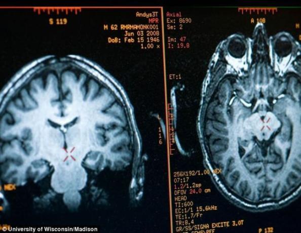 hjerne Mathieu Ricard bilde oppnådd ved MRI