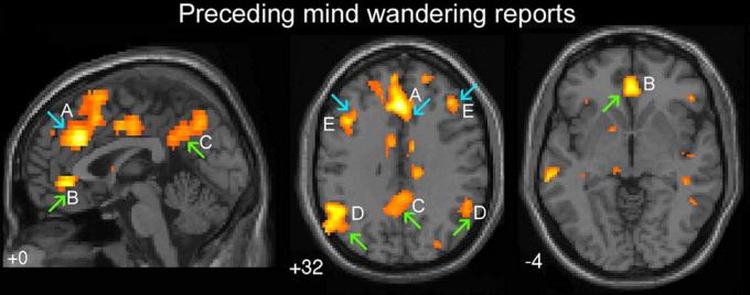 Grønne piler indikerer områder av hjernen som er ansvarlig for "automatisk atferd". Blå pil - "executive" delen av hjernen. A - dorsal cingulate, B - ventralanya cingulate, C - precuneus cerebrale hemisfærer, D - bilateral temporoparietal koplings, E - dorsolateral prefrontal cortex